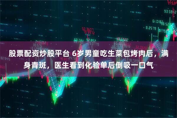 股票配资炒股平台 6岁男童吃生菜包烤肉后，满身青斑，医生看到化验单后倒吸一口气